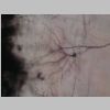 Neuronas Golgi 19.jpg